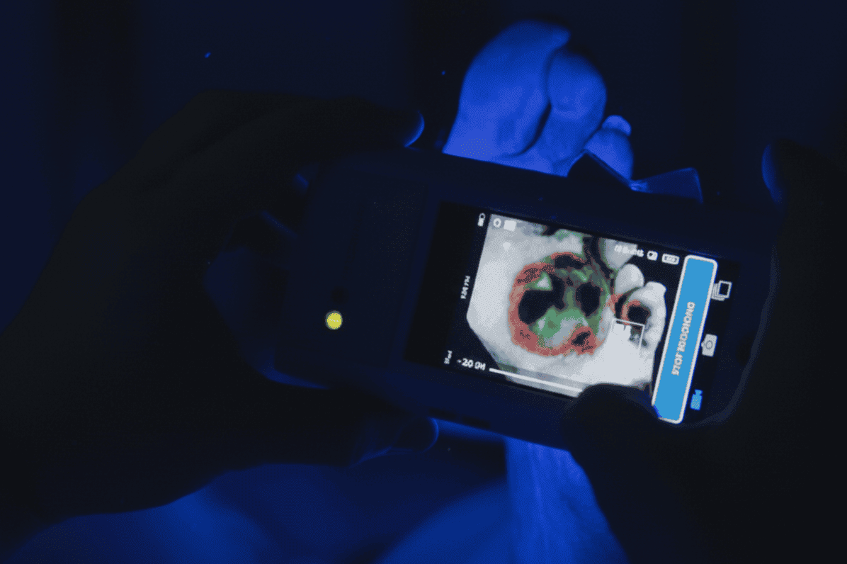 Advanced Wound Care, Delivered